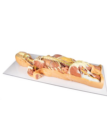 Dissection du système nerveux (vue arrière) - Erler Zimmer 3D anatomy Series MP1400